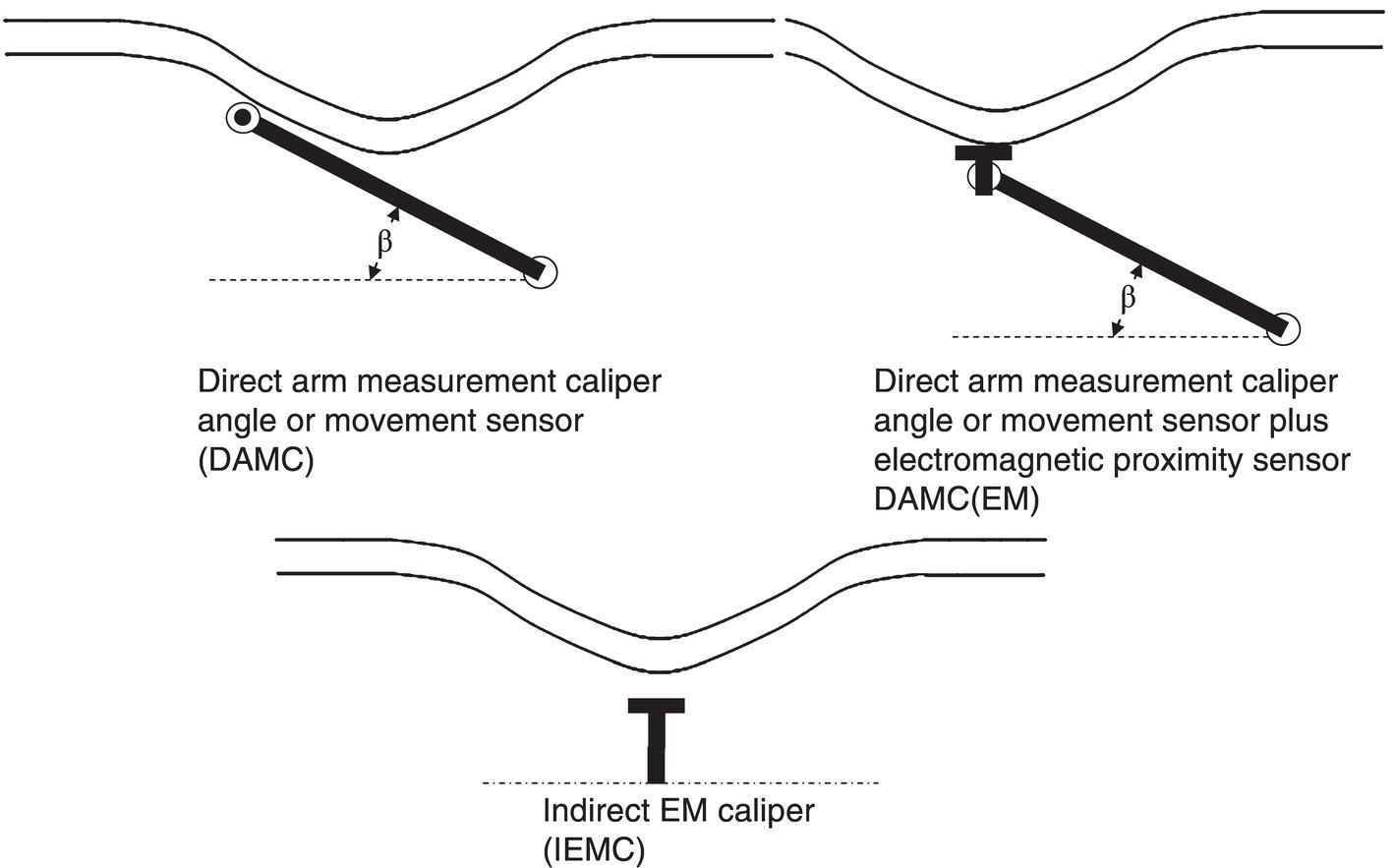 An illustration showing three types of caliper sensor technology used for dent characterization.